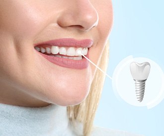 A closeup highlighting a woman’s dental implant