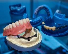 Implant denture illustration showing secure fit in Houston 