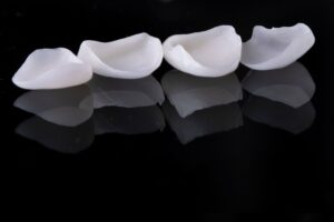 Four veneers on reflective black surface